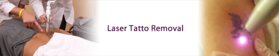 laser-tatoo-removal-banner